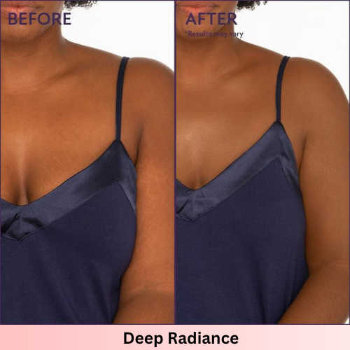 LumiVeil™- Instant Body Coverage Cream